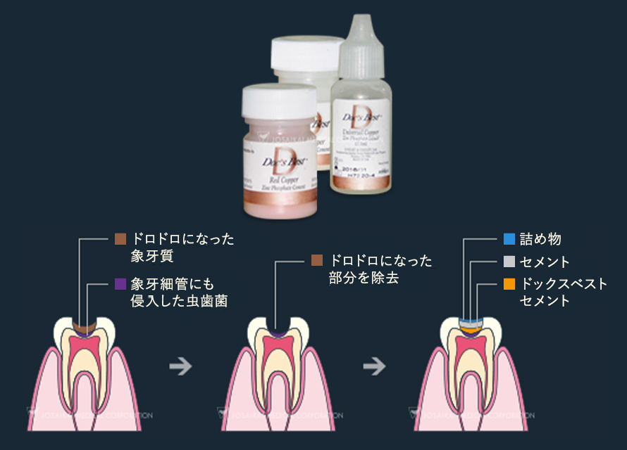 ドックスベストセメント