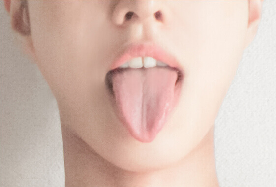 舌の痛み（舌痛症）